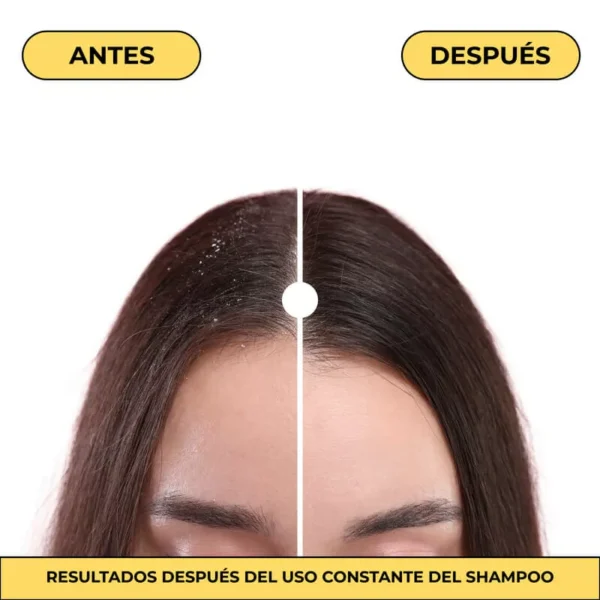 Shampoo Naissant Hidratante Control Caspa 300ml - Imagen 2